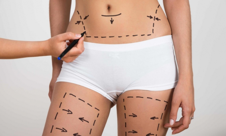 Liposuction Operasyonu Sonrası Kilo Verme Yolları