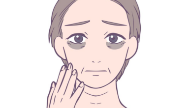 Doğal Yöntemlerle Göz Altı Morluklarını Azaltmanın Yolları