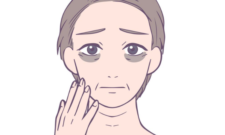 Doğal Yöntemlerle Göz Altı Morluklarını Azaltmanın Yolları